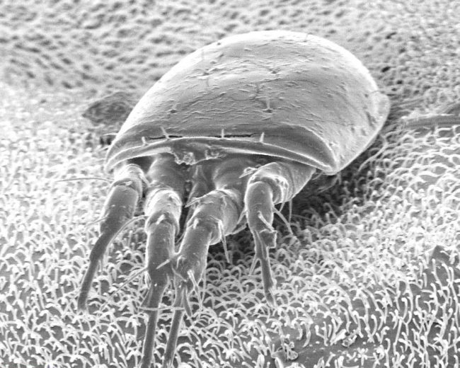 Do Air Purifiers Get Rid Of Dust Mites? Breathe Quality